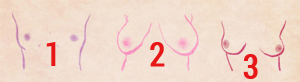 st1