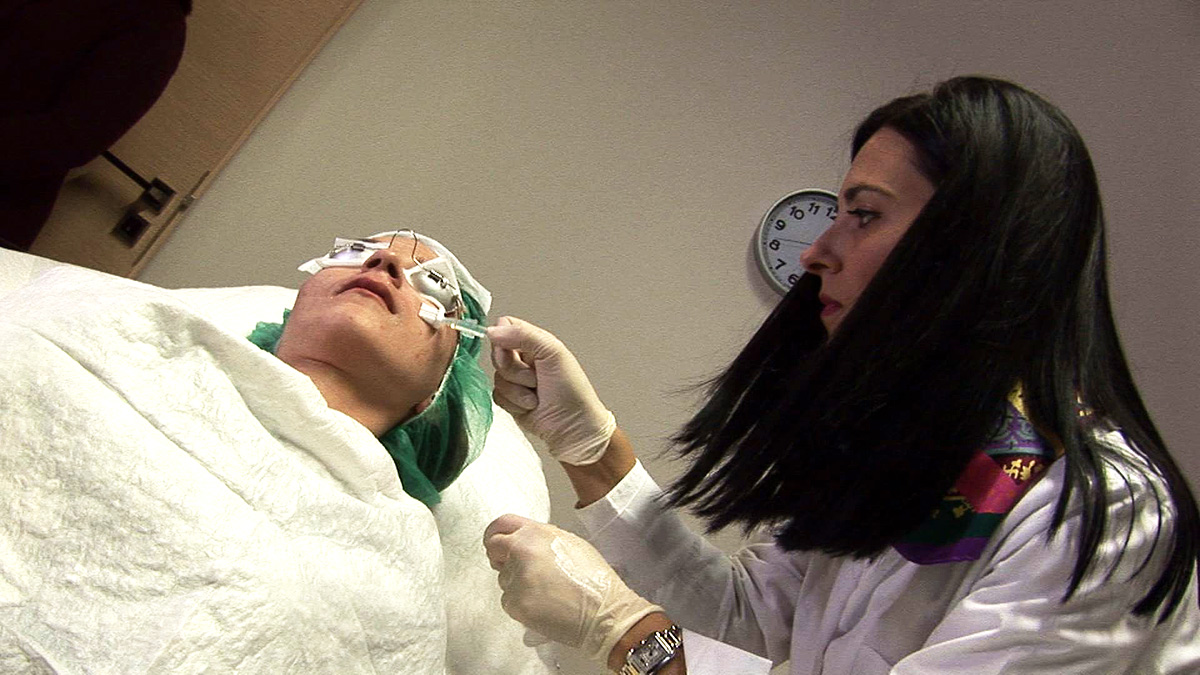 peeling1
