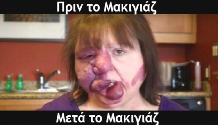 Βίντεο: Το Σημάδι στο Πρόσωπό της, την έκανε να Ντρέπεται να βγει έξω. Πλέον, με τη Βοήθεια του Μακιγιάζ, έχει τη ζωή που της αξίζει!