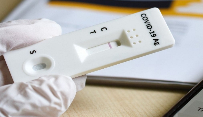 Μειώνονται τα self test στα σχολεία προανήγγειλε ο υπουργός Υγείας, Θάνος Πλεύρης
