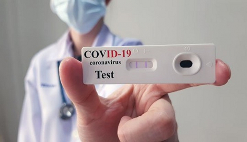 Rapid test: Δωρέαν μία φορά την εβδομάδα για όλους τους Έλληνες