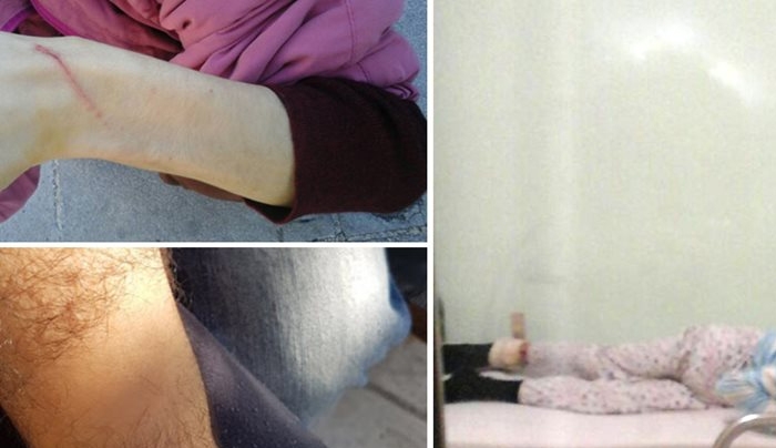 Τραγική εξέλιξη: Απεβίωσε ένα από τα άτομα με αυτισμό που έδεναν στο Λοιμωδών