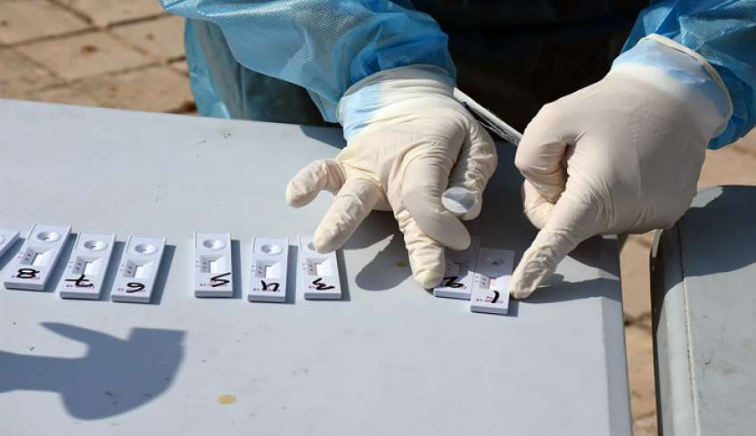 Τι ισχύει για τα rapid test των ανεμβολίαστων εργαζόμενων – Νέες διευκρινίσεις από το υπουργείο Εργασίας