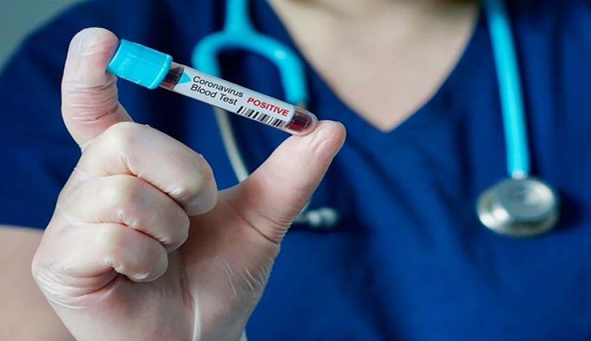 Κορωνοϊός: 57 νέα κρούσματα – 10 σε πύλες εισόδου